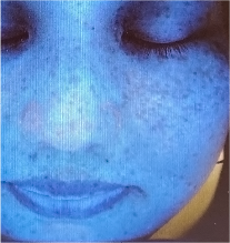 毛穴のつまり イメージ