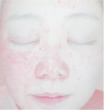 血行状態 イメージ