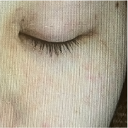 血行不良 イメージ