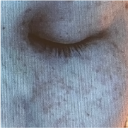 血行不良 イメージ