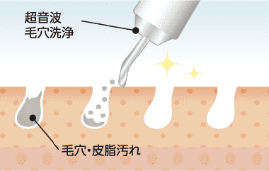 毛穴洗浄 イメージ